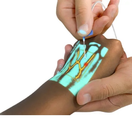 Vein Finder